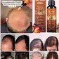 Sérum de grado clínico contra la caída del cabello y para el crecimiento capilar