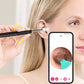 ⏳Oferta por tiempo limitado⏰Dispositivo para la eliminación de cerumen con cámara HD