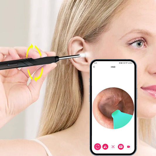 ⏳Oferta por tiempo limitado⏰Dispositivo para la eliminación de cerumen con cámara HD