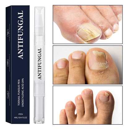 ✨Nuevas llegadas🔥Pluma para tratamiento de hongos en las uñas dañadas